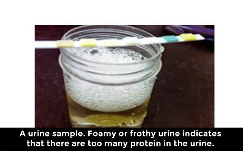 When A Nurse Is Checking The Urinalysis, Plasma Proteins Should Be Absent From The Urine Because _________.