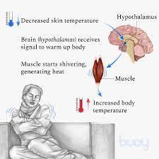 Which of the following clinical findings suggests a cause of a patient's hyperthermia other than heatstroke?A)