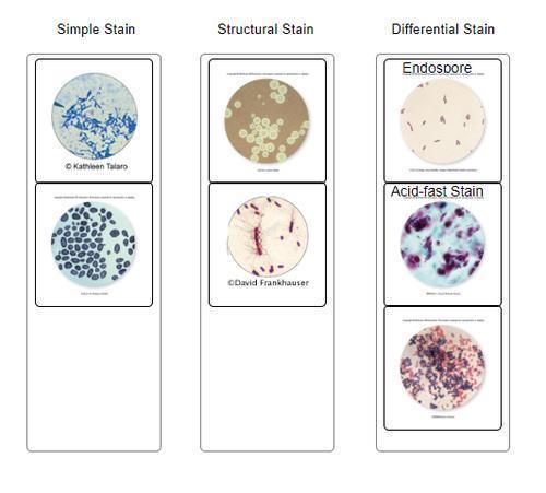 Ag The Images To Their Corresponding Class To Test Your Understanding Of Various Types Of Microbiological