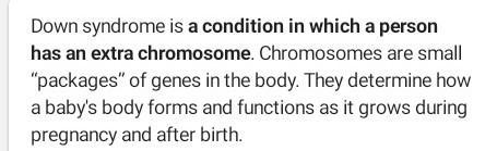 What is Down syndrome