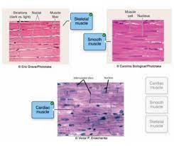 Label the parts of the muscle tissue as indicated in the image.