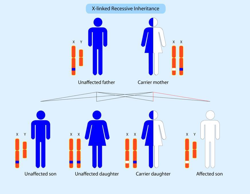 One Type Of Muscular Dystrophy, Duchenne Muscular Dystrophy, Is Is An Inherited Condition That Usually