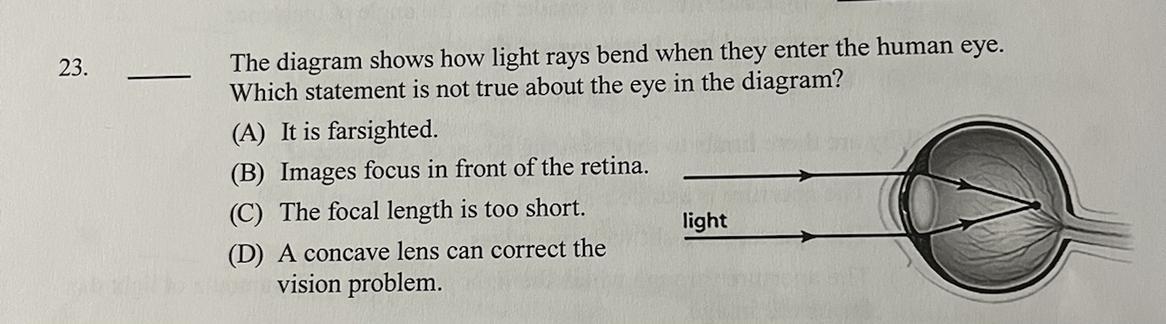 The diagram shows how light rays bend when they enter the human eye.Which statement is not true about