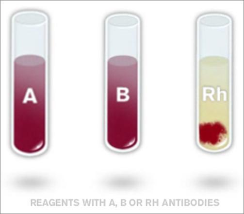 What Types Of Donor Blood Are Compatible? Select All That Apply:a. AB+b. O-c. B-d. A+e. AB-f. B+g. A-h.