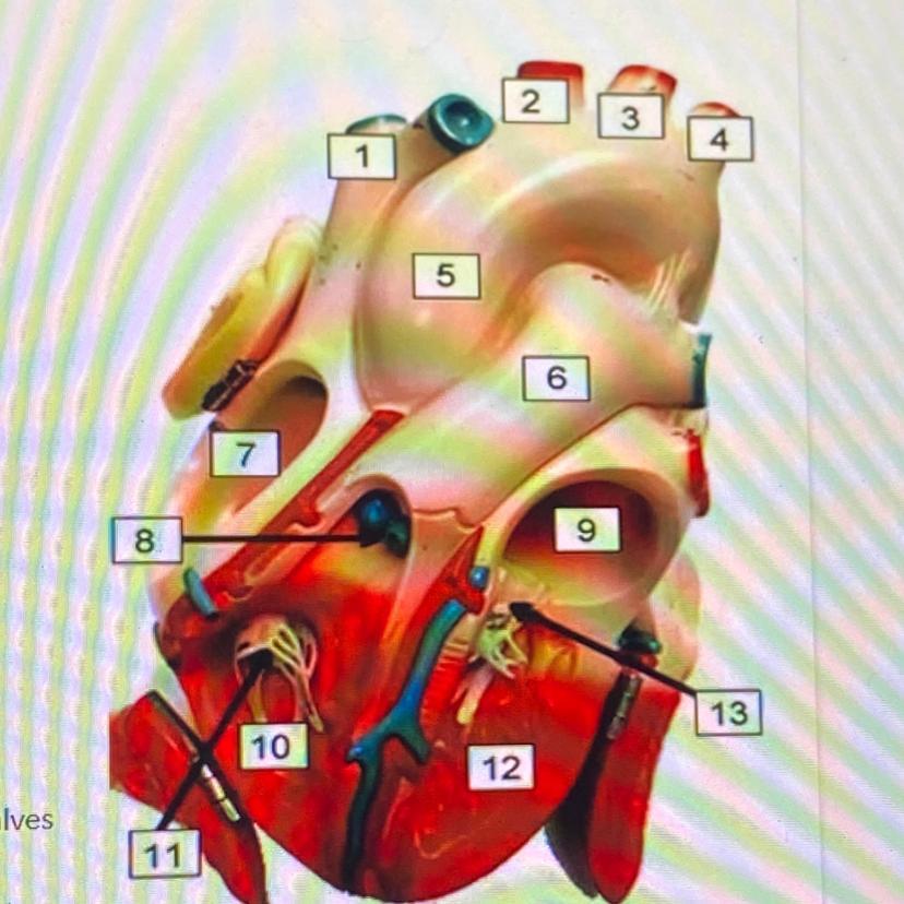 label the heart 1.2.3.4.5.6.7.8.9.10.11.12.13.