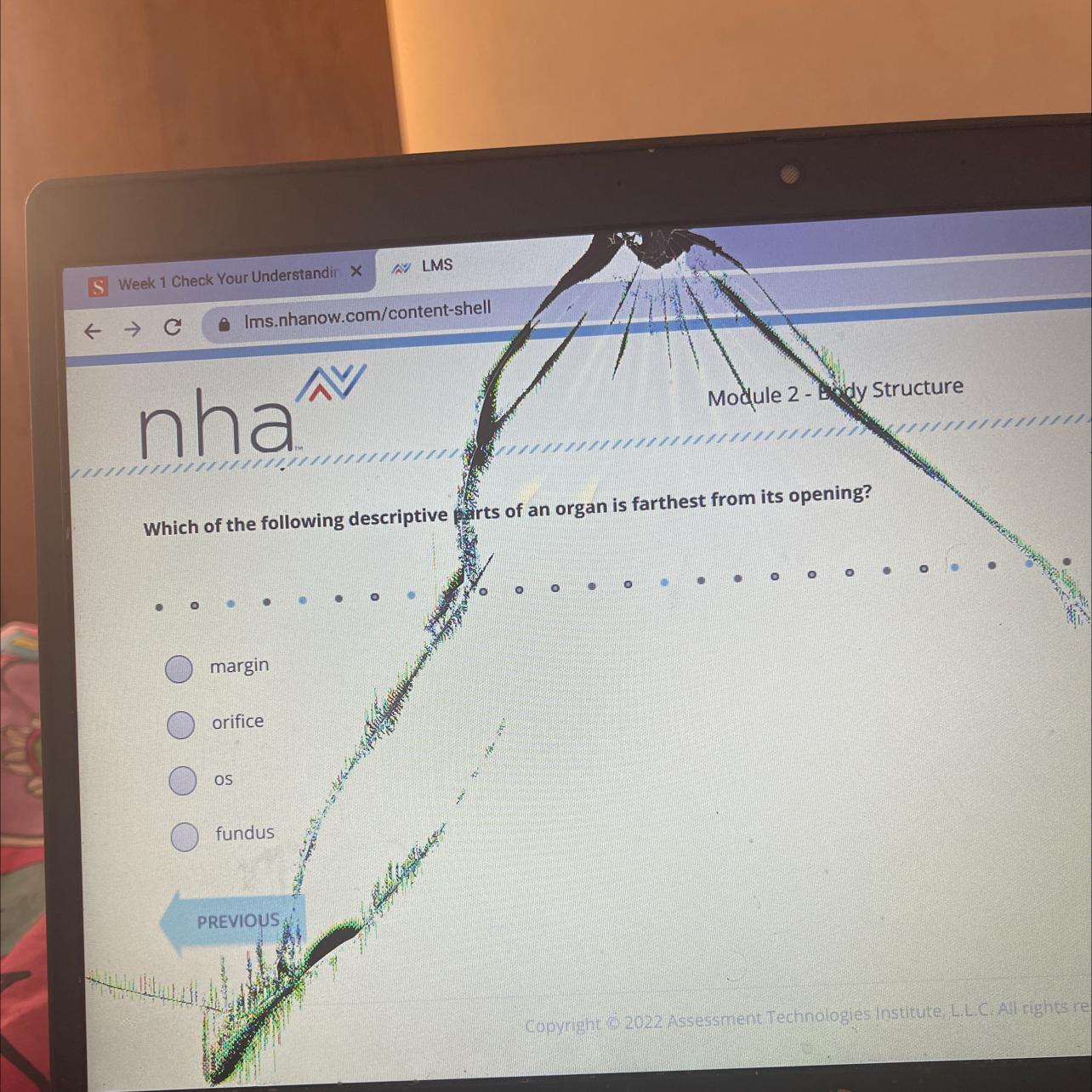 Which of the following descriptive parts of an organ is farthest from its opening?marginorificeOSfundusPREVIOUSOOOOO