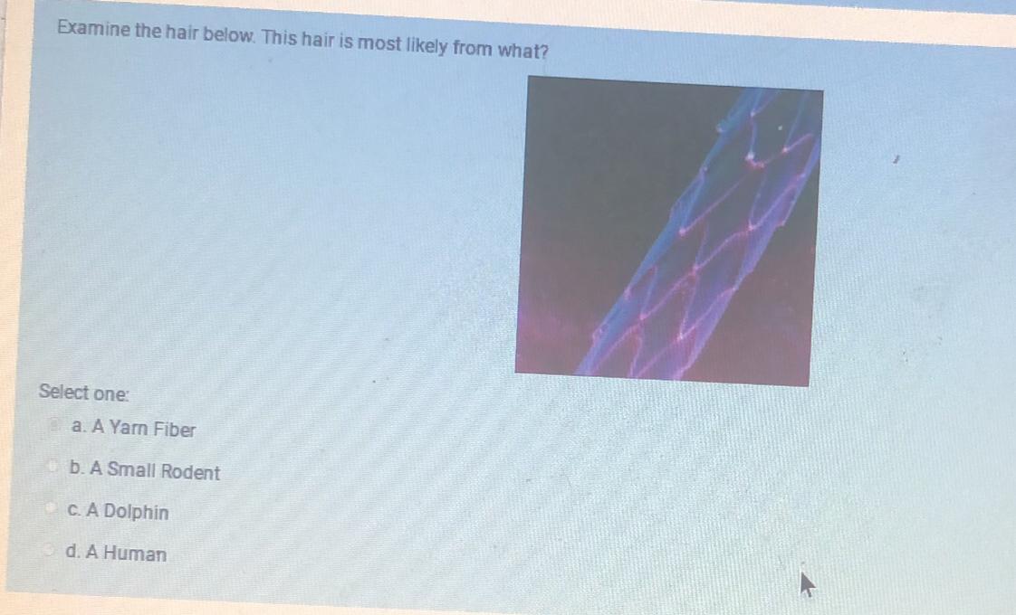 MEDICAL FORENSICS Please Help Me Identify What Hair This Is :)