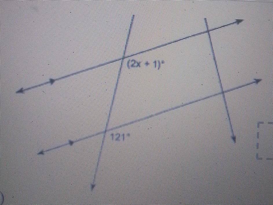 help pleasesolve for x