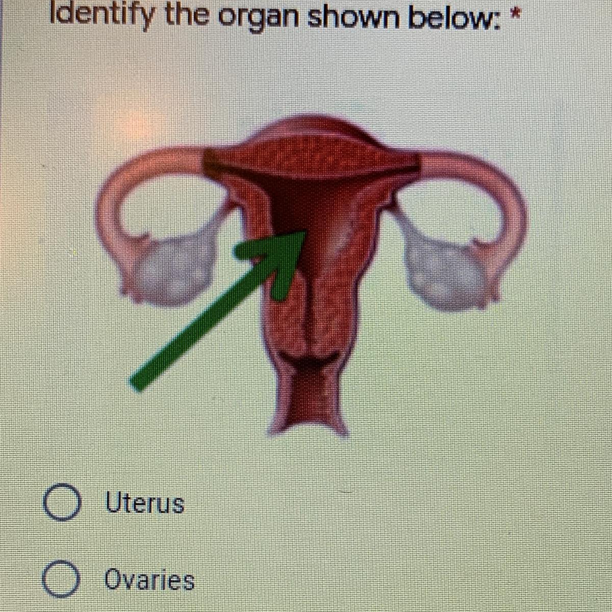 Identify the organ shown below:A. UterusB. OvariesC. VaginaD. Fallopian tubes