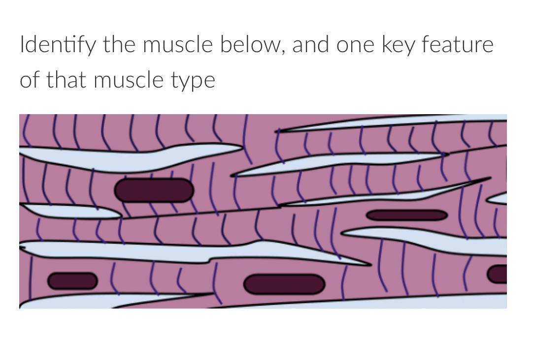 Identify the muscle below l, and one key feature of that muscle type. (Please and thank you.)