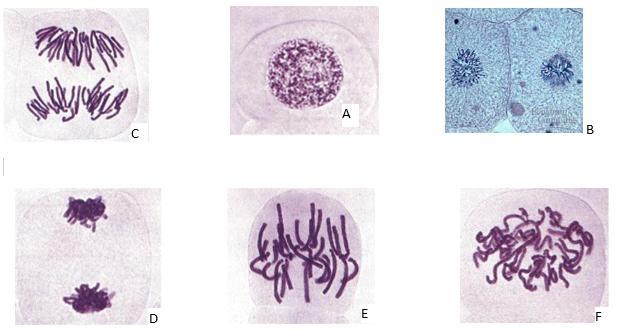 HEEELP MEEEEEThe Following Are Microscope Images Of Cells Going Through A Cell Division Process. Use
